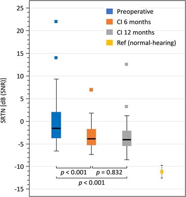 The Effectiveness of Unilateral Cochlear Implantation on Performance-Based and Patient-Reported Outcome Measures in Finnish Recipients